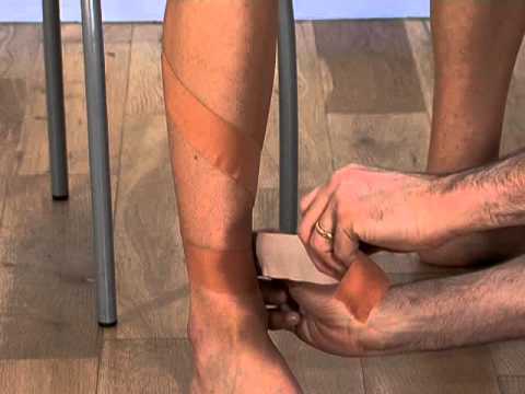 medial tibial stress syndrome taping