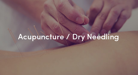 Backs & Beyond Acupuncture